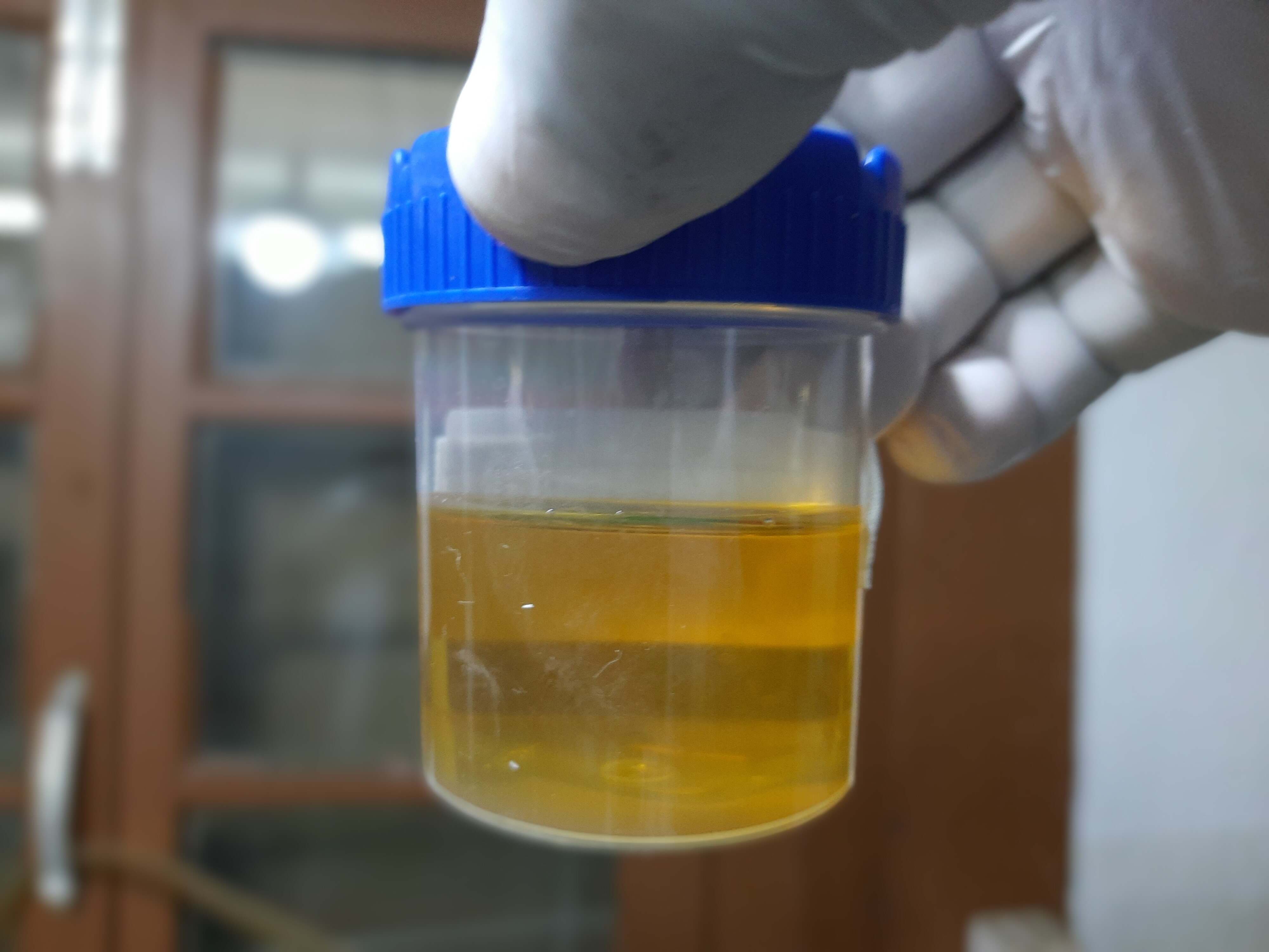 關於尿液分析的31個事實